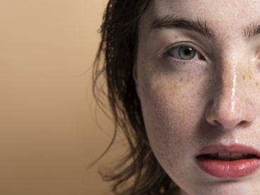 Close-up of a woman with clear, glowing skin after advanced pigmentation management treatment in Riyadh.