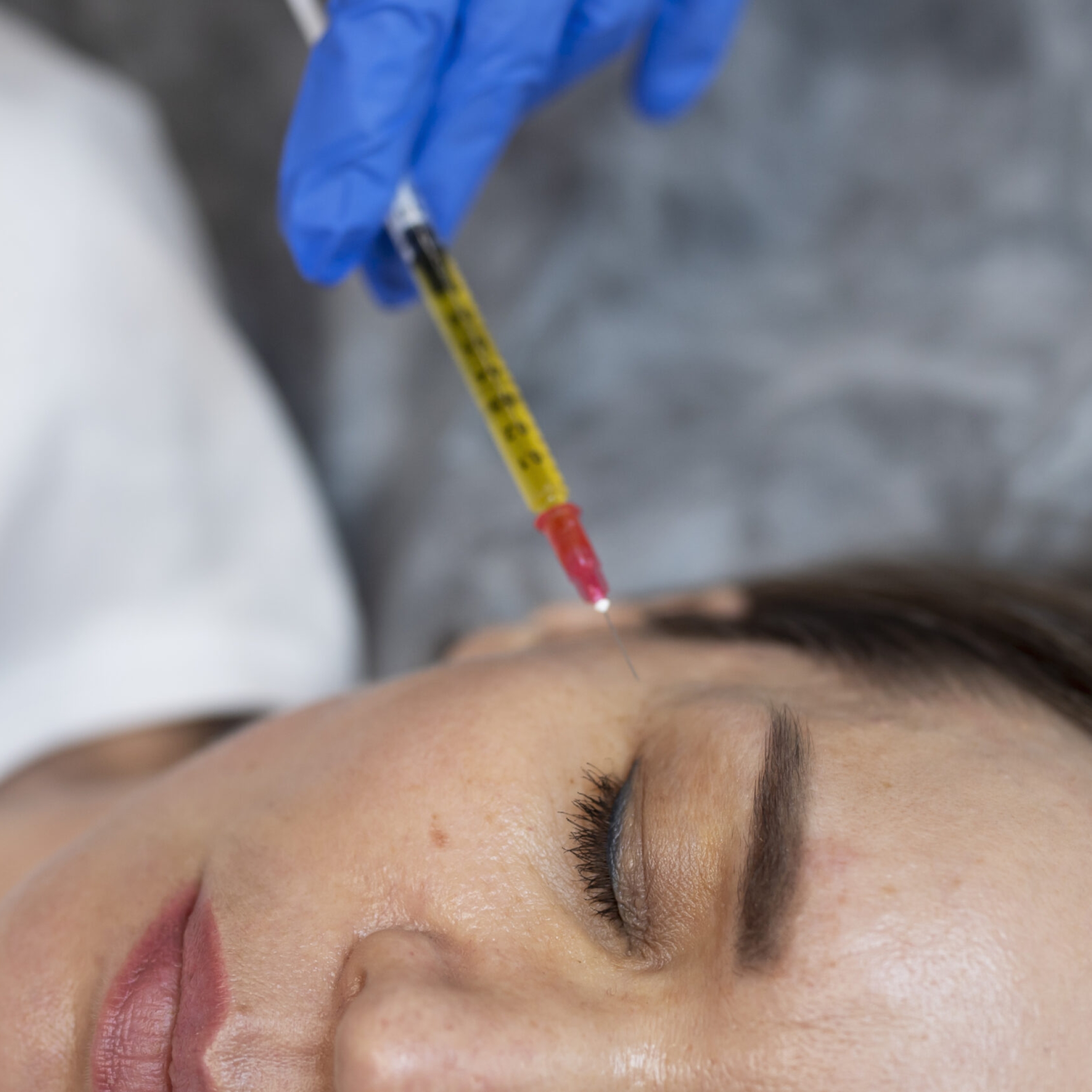 Pigmentation-fighting skincare products for melasma management