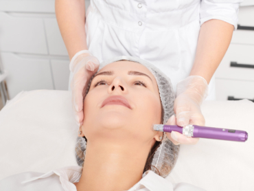 Dermatologist performing radiofrequency microneedling for non-surgical face lift.