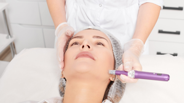 Dermatologist performing radiofrequency microneedling for non-surgical face lift.