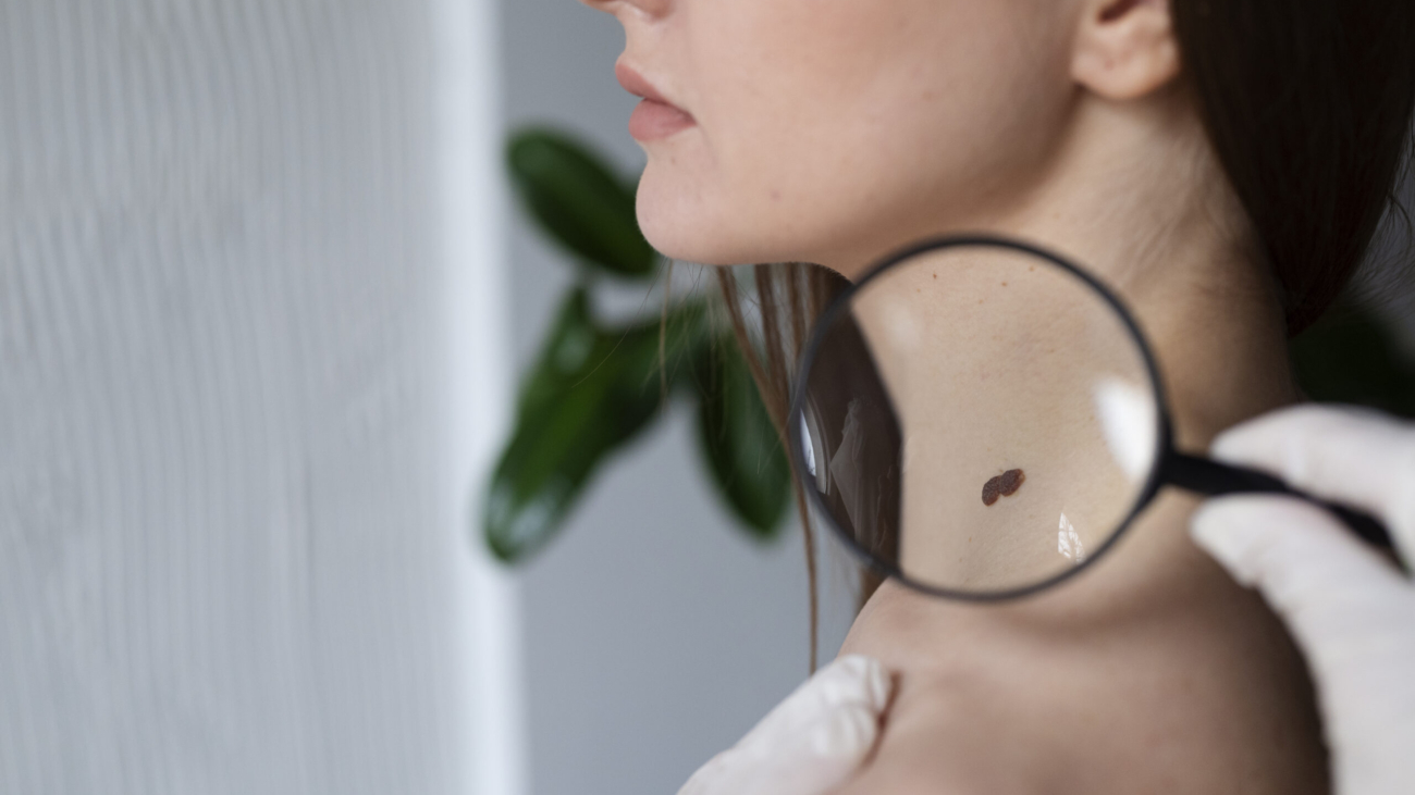 AI-powered mole analysis and digital skin scan in clinic 2025