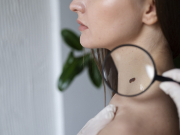 AI-powered mole analysis and digital skin scan in clinic 2025