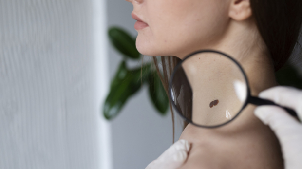 AI-powered mole analysis and digital skin scan in clinic 2025