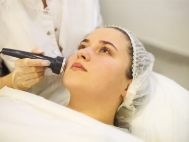 Laser treatment being performed on facial pigmentation in a clinic