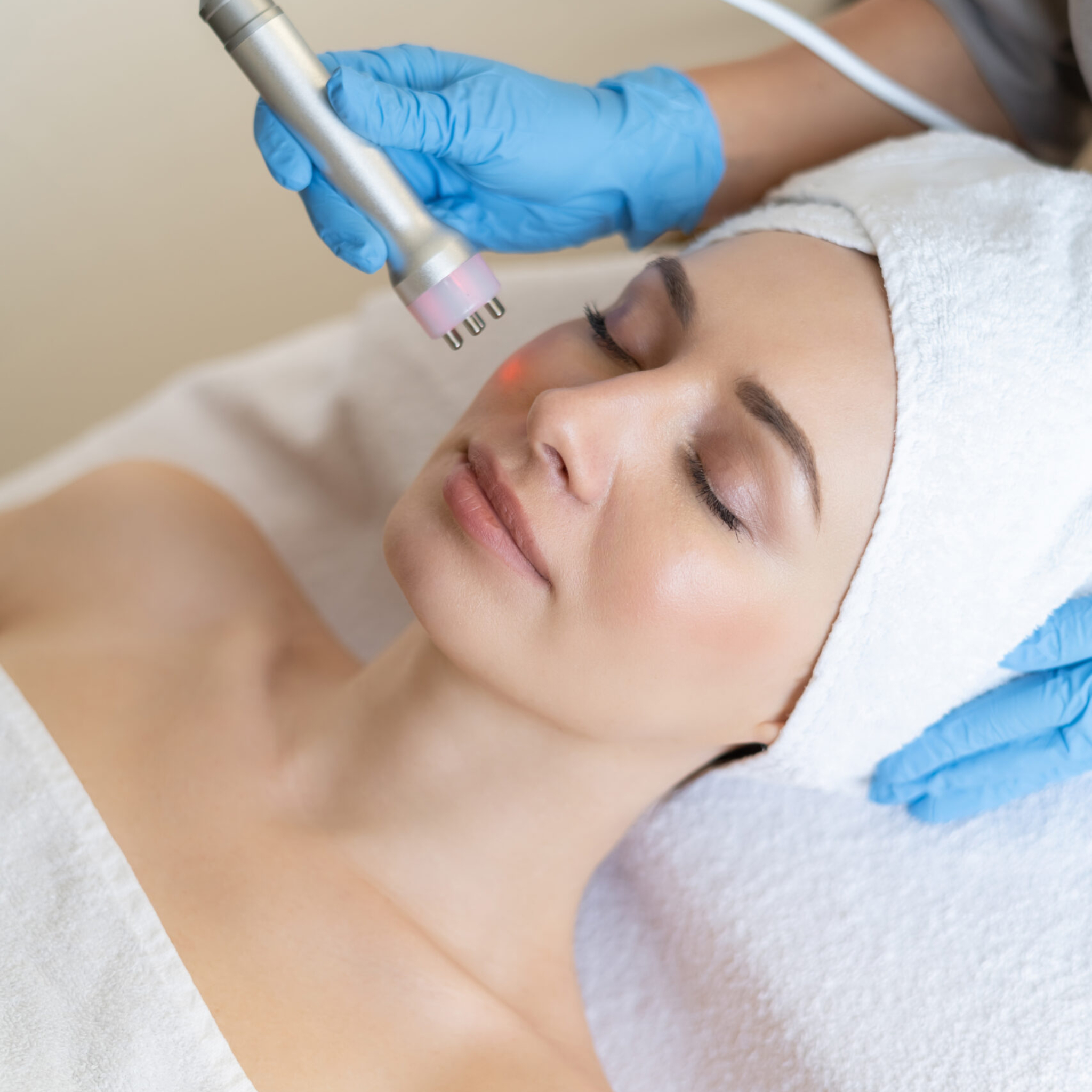 Woman receiving RF microneedling for skin tightening