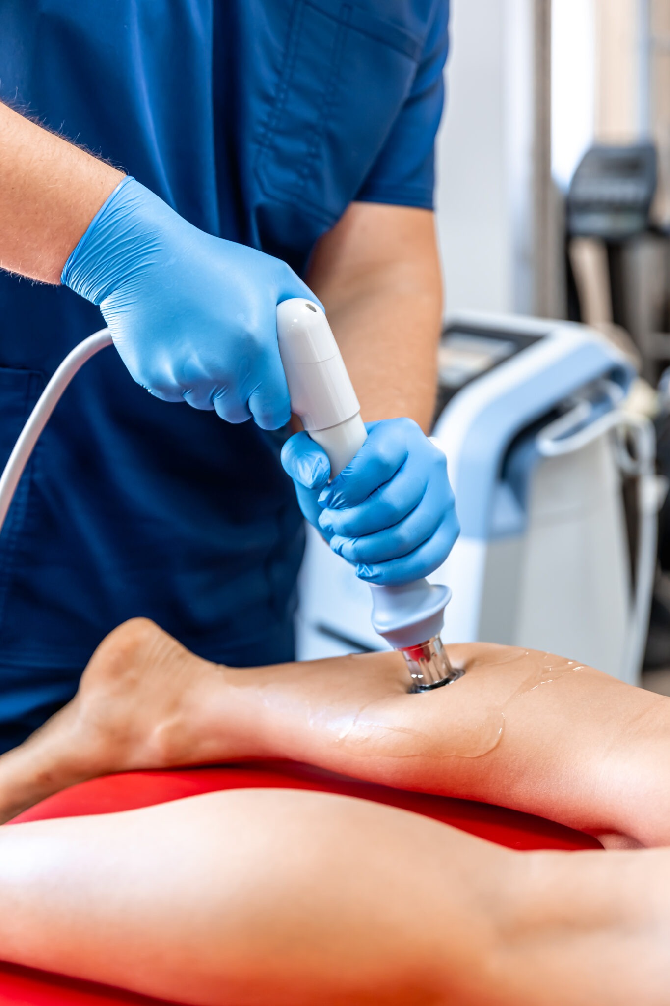 Doctor applying fractional CO2 laser treatment to scarred skin