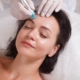 Microneedling treatment for melasma and hyperpigmentation