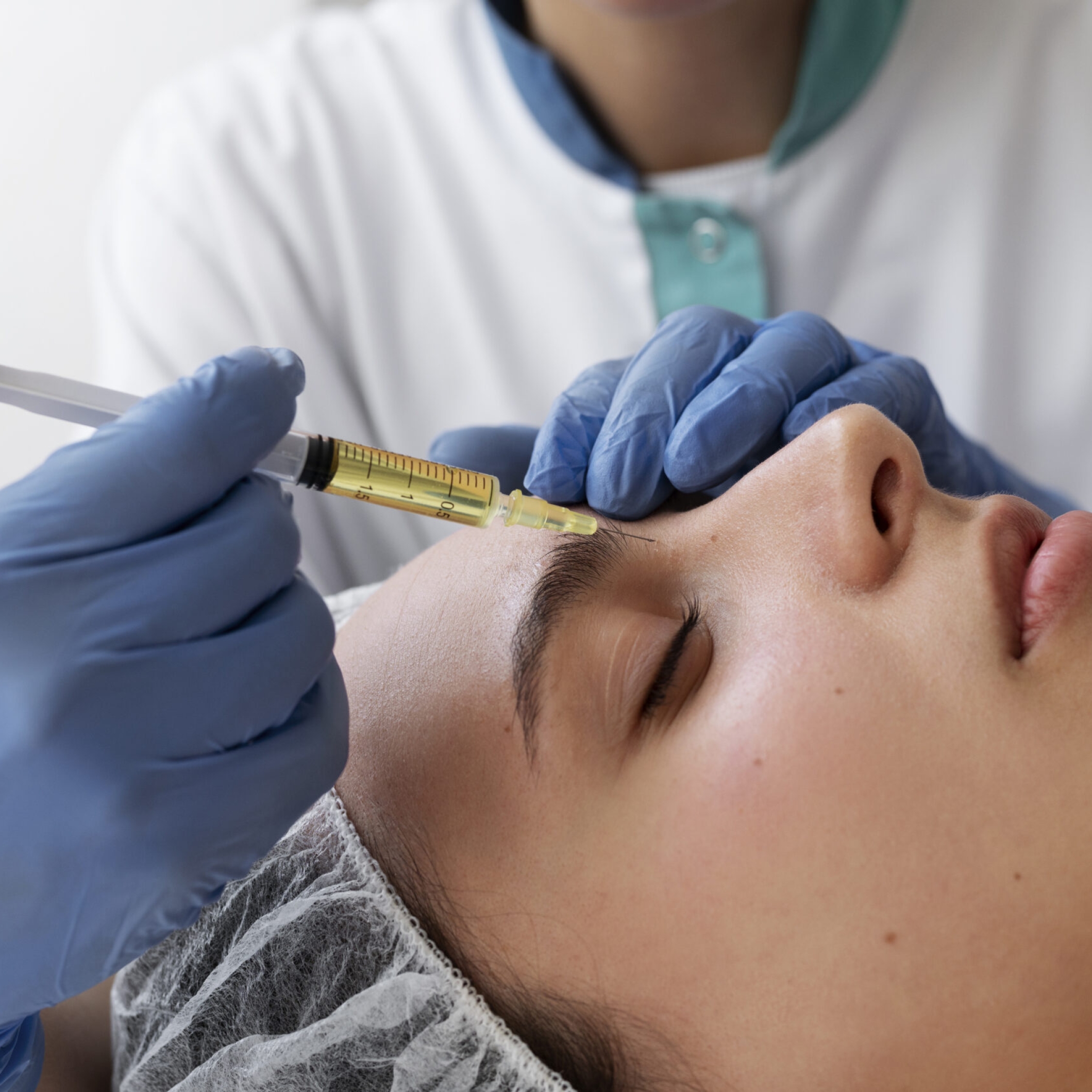 PRP being applied post-microneedling for enhanced healing