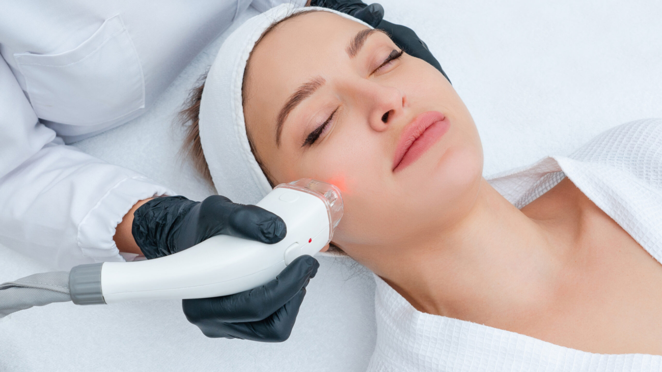 Laser acne scar treatment at Dermatology Clinic.