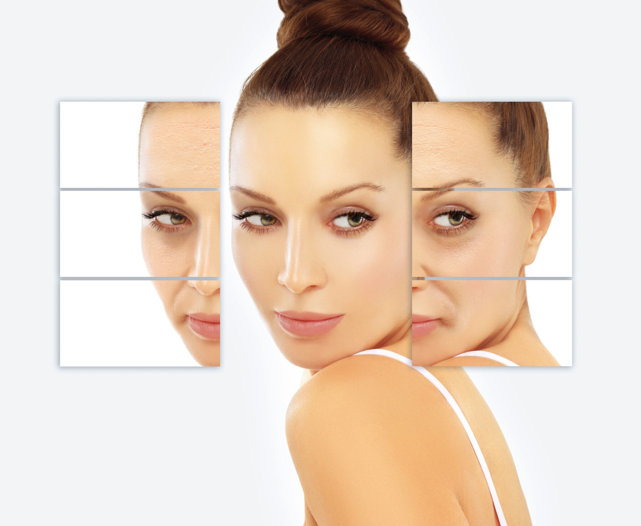 Before and after Exosome Therapy results showing improved skin clarity and texture at Reveal Clinics Riyadh.