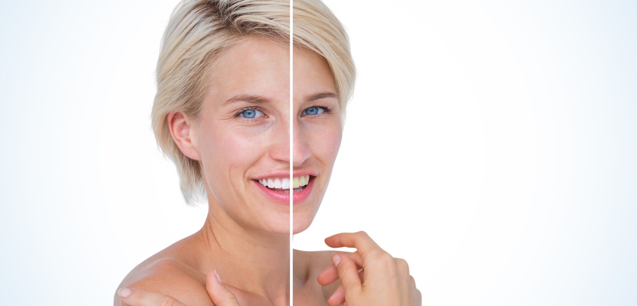 Collagen regeneration and skin renewal after laser resurfacing treatment.