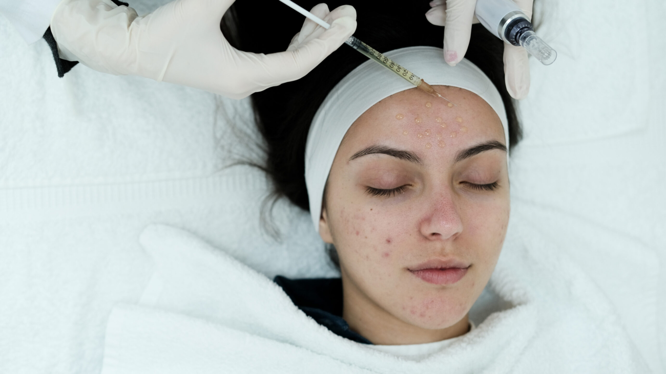 Advanced acne scar treatment at a dermatology clinic in Riyadh
