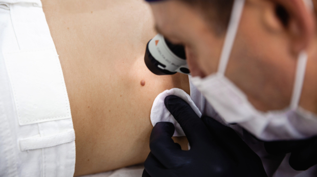 Smart mole management treatment with precision skin evaluation