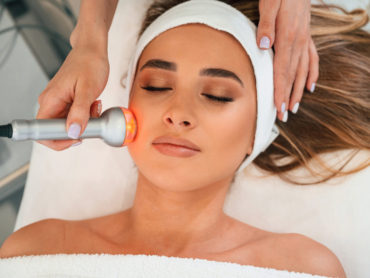 Acne scar treatment before Ramadan consultation