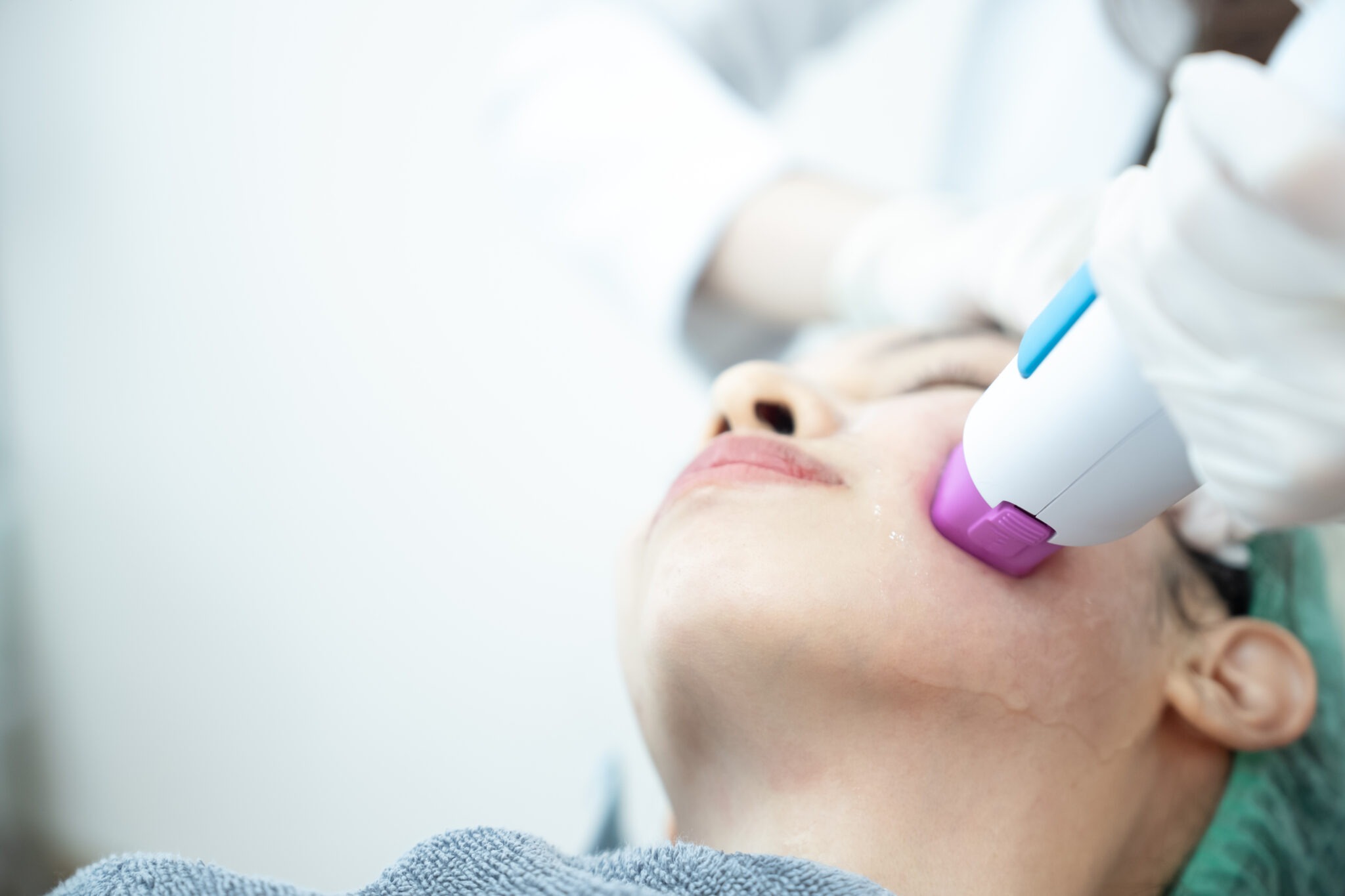 Laser acne scar treatment at Reveal Clinics Riyadh