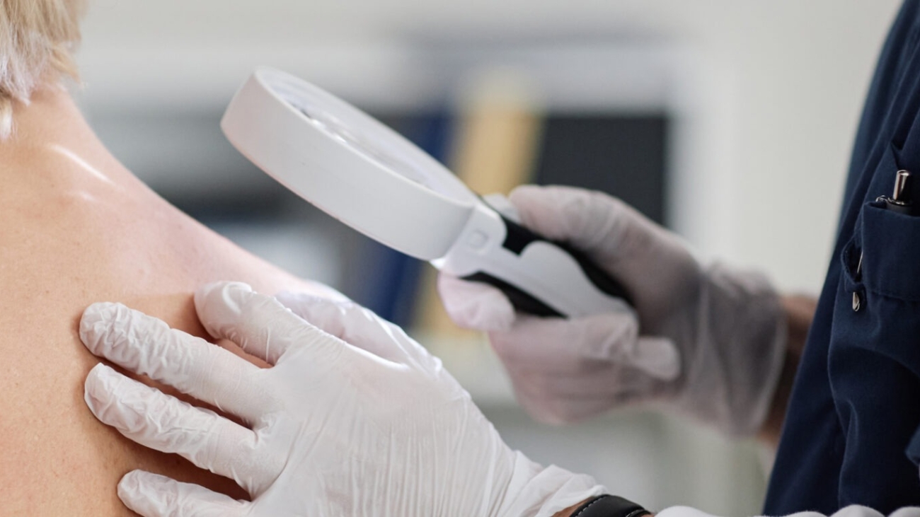 Dermatologist examining mole during Ramadan consultation