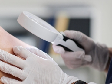 Dermatologist examining mole during Ramadan consultation