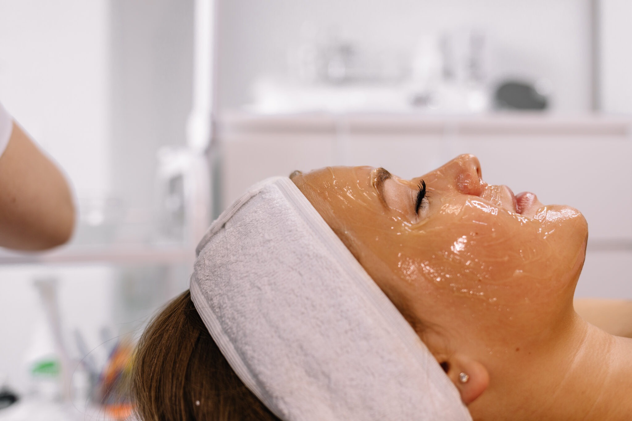 Chemical peel for pigmentation before Ramadan