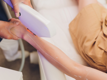 Laser hair removal during Ramadan fasting in Riyadh