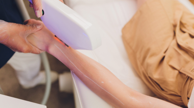 Laser hair removal during Ramadan fasting in Riyadh