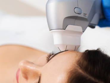 HIFU non-surgical face lifting before Ramadan in Riyadh