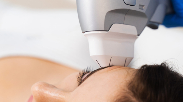 HIFU non-surgical face lifting before Ramadan in Riyadh